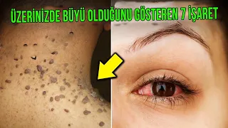 Üzerinizde Büyü Olduğunu Gösteren 7 Korkunç İşaret.