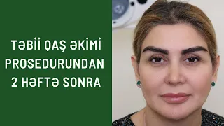 Təbii qaş əkimi prosedurundan 2 həftə sonra 👍🏻✅📩