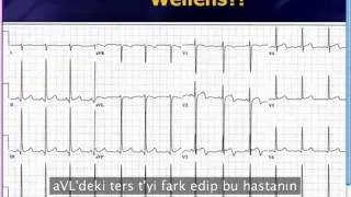 Mattu EKG Vakaları 100. Bölüm ve İlk 100 Bölümden seçmeler