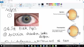 aphakia || ophthalmology