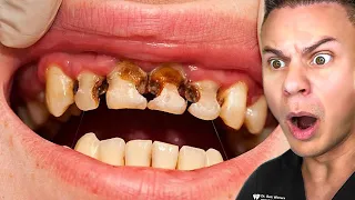 Disgusting Dental TikToks That Are Painful To Watch