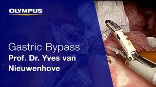 Laparoscopic Roux-en-Y Gastric Bypass | THUNDERBEAT | Prof. Dr. Yves van Nieuwenhove