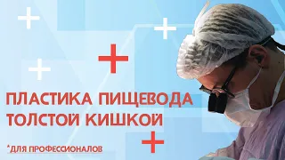 Пластика пищевода толстой кишкой