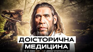 Як лікувались неандертальці та Homo Sapiens в епоху каменю | Історія медицини