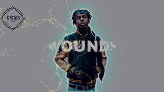 [FREE] Polo G x Roddy Ricch ft  Gunna Type Beat - Wounds | Rap Instrumental