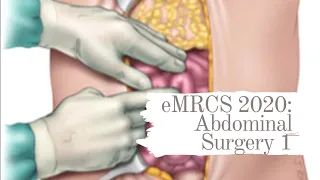 eMRCS 2020: Abdominal Surgery 1