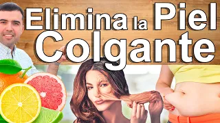 Piel Colgante Nunca Más - Remedios Caseros Para Mejorar Y Lucir Una Piel Firme Y Saludable