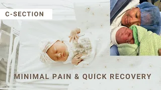 Positive C-Section Journey: Minimal Pain, Swift Recovery, Maximum Positivity!