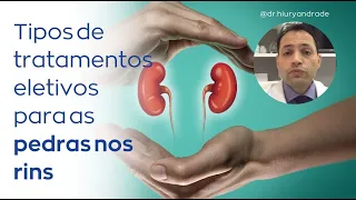 Tipos de tratamentos eletivos para as pedras nos rins - Dr. Hiury Silva Andrade