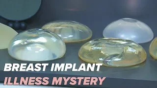 Surgeon: "Breast implant illness a mystery"