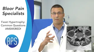 Facet Hypertrophy - What Is It? & Other Common MRI Questions - Compilation