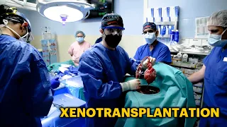 Animal-to-Human Transplants