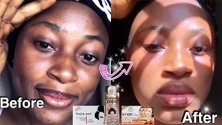 1 MONTH SKIN TRANSFORMATION/ Detailed Kojic acid Products Review And skincare products for beginners
