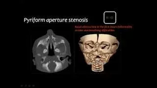 Prof.Mamdouh Mahfouz -  Craimofacial anomalies -  Sohag