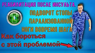 Подворот стопы при шаге парализованной ногой после инсульта - как исправить.