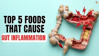 Top 5 Foods Triggering Gut Inflammation 🚫