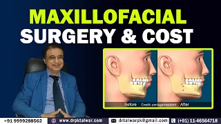 What is Maxillofacial Surgery & Cost? | Maxillofacial Surgery in Delhi, India | Dr. PK Talwar