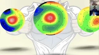 The Cornea Club- 5th Webinar- Samer Hamada/ Shady Awwad/ Artemis Matsou