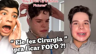 OLHA A ROTINA DESSE GAROTO DEPOIS DA CIRURGIA ORTOGNÁTICA