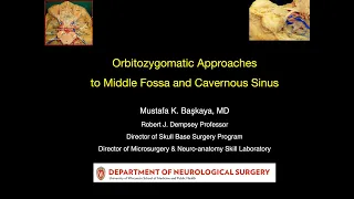 ✅ Orbitozygomatic Approaches to Middle Fossa and Cavernous Sinus, NASBS Virtual Skull Base Workshop