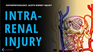 Intrarenal Kidney Injury: Why Nurses MUST Evaluate Urine Status