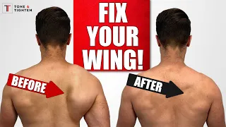 FIX Scapular Winging with Shoulder Blade Exercises