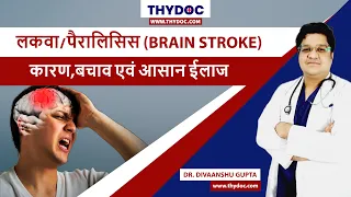 Lakwa Kaise Hota Hai, Brain Stroke Treatment, Brain Stroke Ke Lakshan, Stroke Kya Hota hai