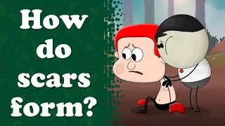 How do scars form? | #aumsum #kids #science #education #children