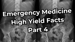 Emergency Medicine Board Exam High Yield Facts (Part 4)