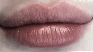 lip lift