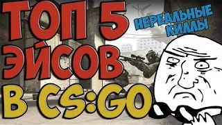 ТОП 5 Эйсов CS:GO)