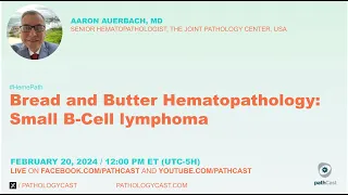 Bread and Butter  Hematopathology: Small B-Cell Lymphoma
