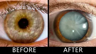 What Happens If You Don't Blink for 30 Days?