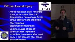 Trauma Day Away 2012 - Acute Nursing Mgmt for Traumatic Brain Injury by Alexander Khalessi, MD, MS