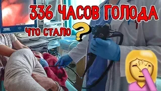 Этот парень не ел 14 дней. Голод. Последствия