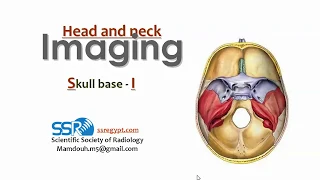 14 Skull Base Imaging ( part 1) - prof.Mamdouh Mahfouz (2019 edition)