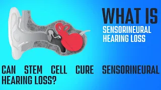 What is Sensorineural Hearing Loss? How can it be treated?