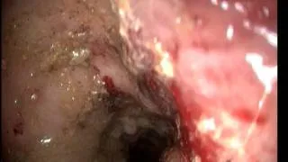 Colonoscopy dog- colitis ulcerosa