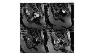 The MRI Experiments Part 2