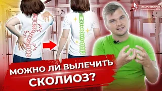 Можно ли вылечить сколиоз?