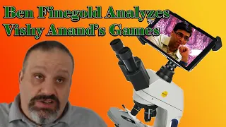 Ben Finegold analyzes Vishy Anand's games!