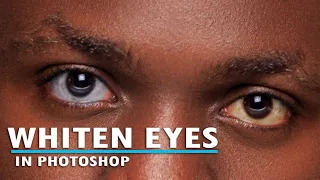 How To Whiten Eyes In Photoshop (The Best Eye and Teeth Whitening Photoshop Tutorial)