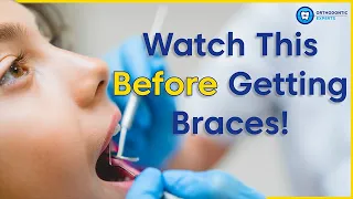 What To Know Before Getting Braces | 8 Tips To Prepare You For Braces