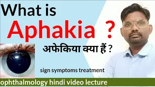 aphakia treatment / what is aphakia / aphakia and Pseudophakia / #aphakia #ophthalmologyhindi