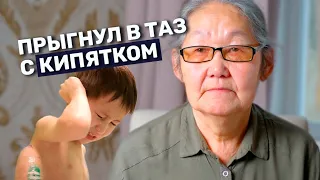 ОЖОГИ ПАХА И ОРГАНОВ ТАЗА I История Антона Моткова