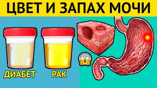 О чем расскажут ЦВЕТ и ЗАПАХ МОЧИ? Срочно проверьте свою МОЧУ! Сигналы серьезных болезней!