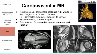 Cardiac Imaging Modalities addition to L3& 4 CHEAST IMAGING