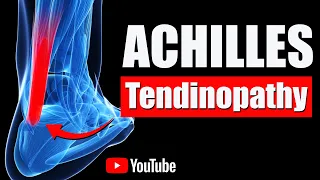 Achilles Pain.. Best Exercises, Stretches & Rehab for Strengthening Achilles Tendon Pain