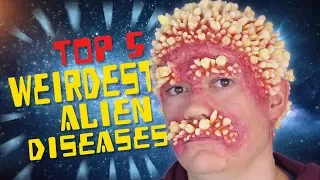 Top 5 Weirdest Alien Diseases