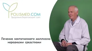 Лечение контагиозного моллюска народными средствами: йод, чистотел, фукорцин, деготь